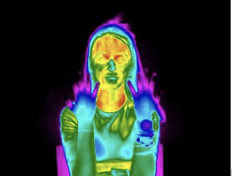 thermography image 2