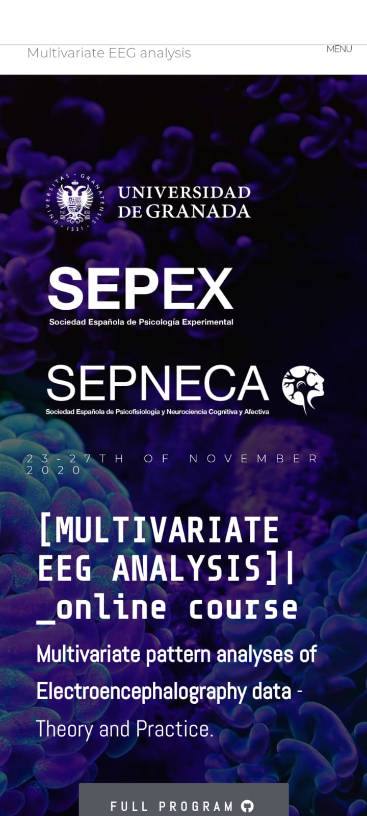 Multivariate pattern analyses of Electroencephalography data: Theory and Practice.