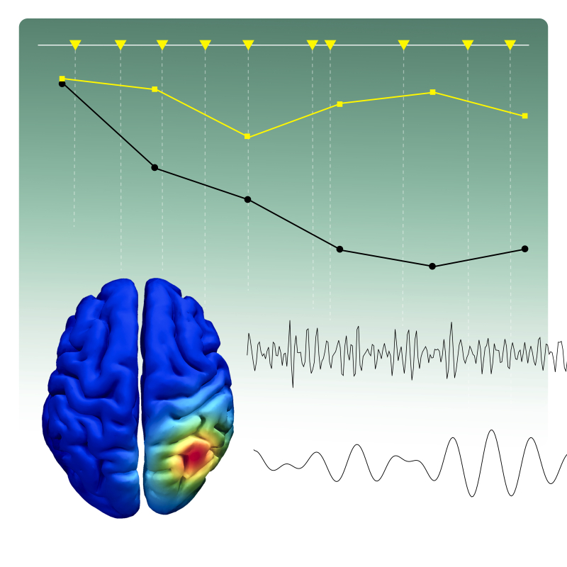 Hemmerich, K., Lupiáñez, J., Luna, F. G., & Martín-Arévalo, E. (2023). The mitigation of the executive vigilance decrement via HD-tDCS over the right posterior parietal cortex and its association with neural oscillations. Cerebral Cortex. https://doi.org/10.1093/cercor/bhac540